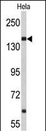 NUP153 Antibody in Western Blot (WB)