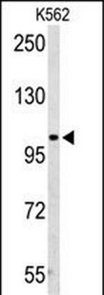 AMPD2 Antibody in Western Blot (WB)