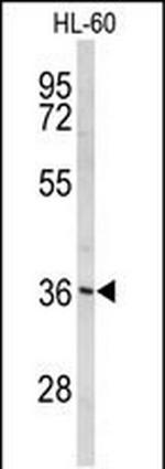 PEX14 Antibody in Western Blot (WB)