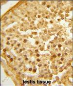 BAHD1 Antibody in Immunohistochemistry (Paraffin) (IHC (P))