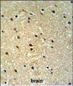 PROX1 Antibody in Immunohistochemistry (Paraffin) (IHC (P))