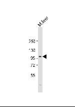 PROX1 Antibody in Western Blot (WB)