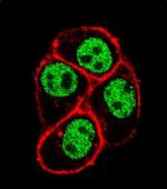 Cdc73 Antibody in Immunocytochemistry (ICC/IF)