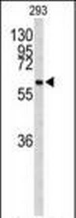 Cdc73 Antibody in Western Blot (WB)