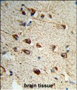 Fibromodulin Antibody in Immunohistochemistry (Paraffin) (IHC (P))