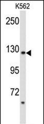 PLCB2 Antibody in Western Blot (WB)