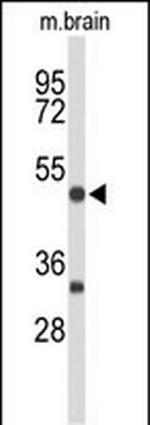 MEF2A Antibody in Western Blot (WB)