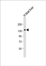 XDH Antibody in Western Blot (WB)