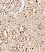 ABCF1 Antibody in Immunohistochemistry (Paraffin) (IHC (P))