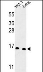 SNRPD3 Antibody in Western Blot (WB)