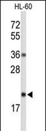 RNaseH2C Antibody in Western Blot (WB)