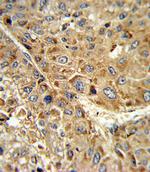 GPX1 Antibody in Immunohistochemistry (Paraffin) (IHC (P))