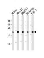 GPX1 Antibody in Western Blot (WB)