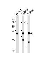 GPX1 Antibody in Western Blot (WB)