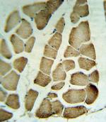 PARVA Antibody in Immunohistochemistry (Paraffin) (IHC (P))