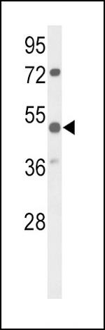 PARVA Antibody in Western Blot (WB)