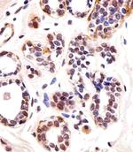 TBX1 Antibody in Immunohistochemistry (Paraffin) (IHC (P))