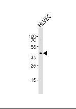 TBX1 Antibody in Western Blot (WB)