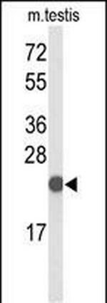 CXXC4 Antibody in Western Blot (WB)