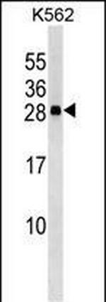 CXXC4 Antibody in Western Blot (WB)