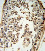 p19 INK4d Antibody in Immunohistochemistry (Paraffin) (IHC (P))