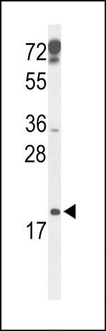 p19 INK4d Antibody in Western Blot (WB)