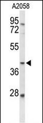 FUT3 Antibody in Western Blot (WB)