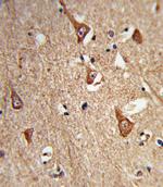 CPLX1 Antibody in Immunohistochemistry (Paraffin) (IHC (P))