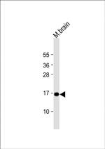 CPLX1 Antibody in Western Blot (WB)