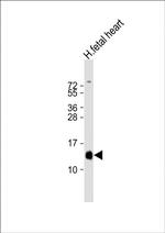 HBA2 Antibody in Western Blot (WB)