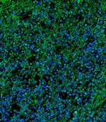 IL2RG Antibody in Immunohistochemistry (PFA fixed) (IHC (PFA))