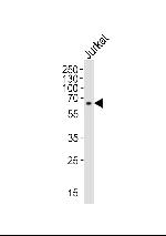 IL2RG Antibody in Western Blot (WB)