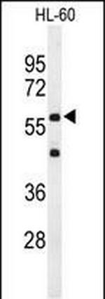 IL2RG Antibody in Western Blot (WB)