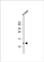 HAMP Antibody in Western Blot (WB)