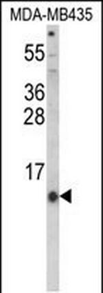 HAMP Antibody in Western Blot (WB)