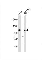 GEN1 Antibody in Western Blot (WB)