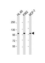 GEN1 Antibody in Western Blot (WB)