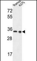 LDHA Antibody in Western Blot (WB)