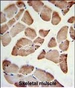 LFNG Antibody in Immunohistochemistry (Paraffin) (IHC (P))