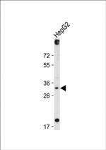 DIO3 Antibody in Western Blot (WB)