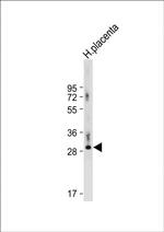 DIO3 Antibody in Western Blot (WB)