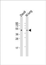 TAT Antibody in Western Blot (WB)