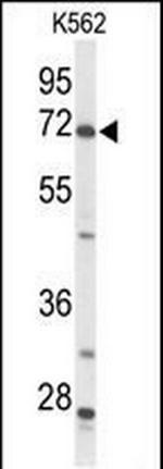 ACSS2 Antibody in Western Blot (WB)