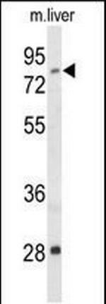 ACSS2 Antibody in Western Blot (WB)