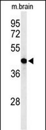 AGPAT6 Antibody in Western Blot (WB)