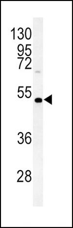 DGAT2 Antibody in Western Blot (WB)