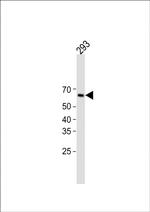 Cytokeratin 1 Antibody in Western Blot (WB)