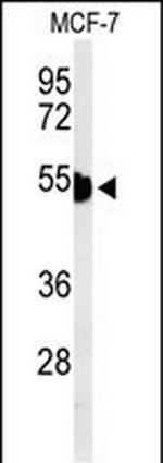 Cytokeratin 1 Antibody in Western Blot (WB)