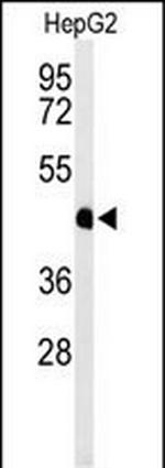 HFE2 Antibody in Western Blot (WB)