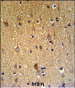 ZDHHC9 Antibody in Immunohistochemistry (Paraffin) (IHC (P))